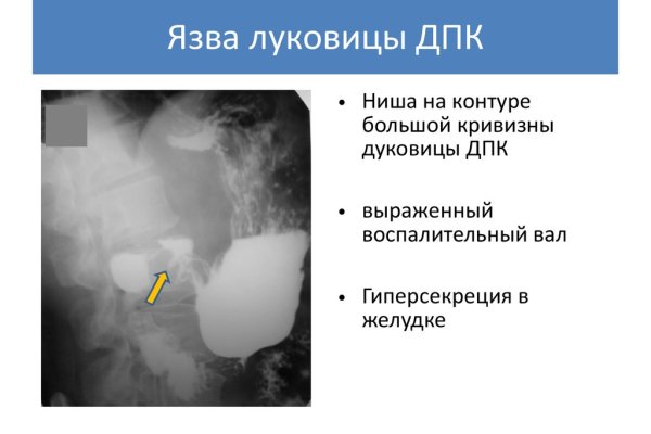 Что такое кракен сайт в россии